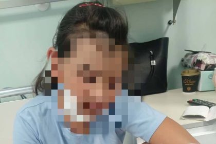 Anais o fetita de 9 ani din Nereju se confrunta cu cancerul Familia are nevoie urgenta de ajutor pentru tratamentul ei medical